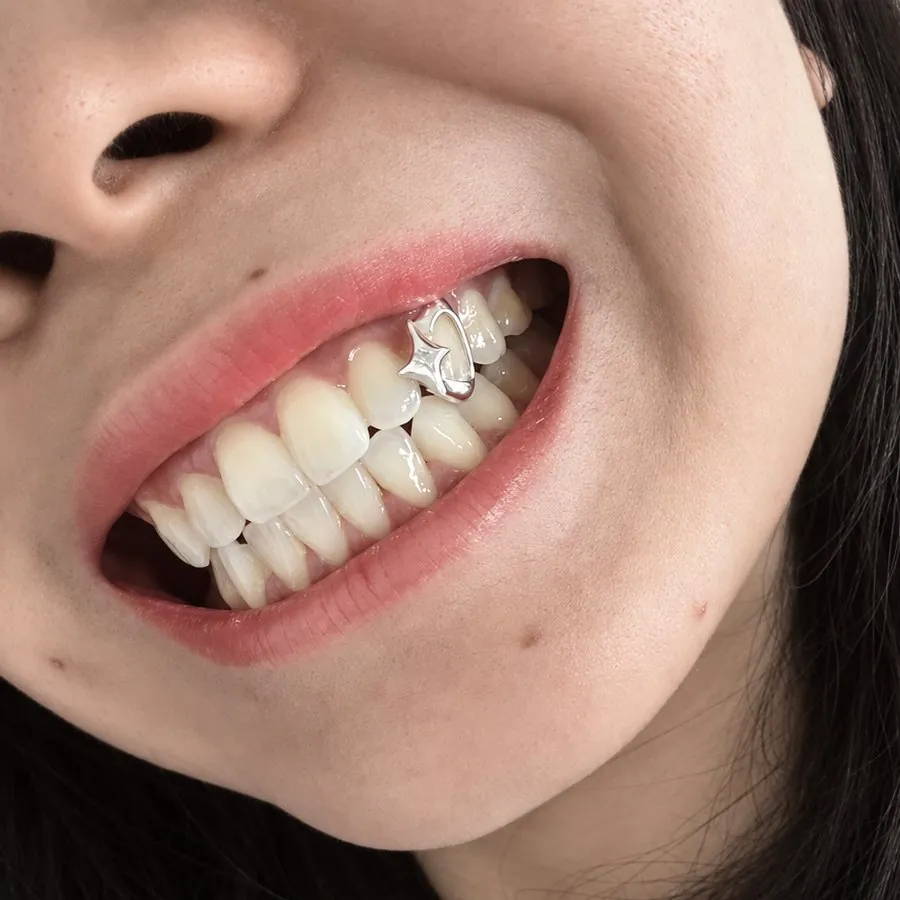 Cận cảnh nụ cười, một chiếc răng cửa đeo viền bạc hở có gắn hình ngôi sao