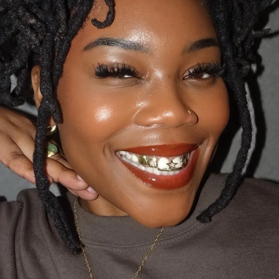 Khách cười để lộ hàng răng trên đeo grillz mạ vàng, một răng có hình ngôi sao